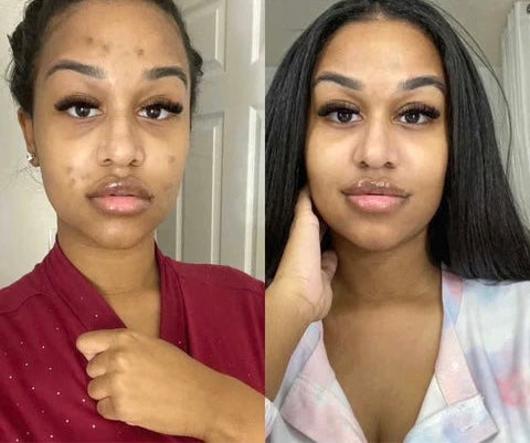 Turmeric Clear Skin Soap