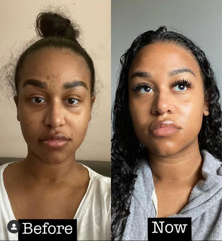 Kojic acid & Turmeric Brightening Soap