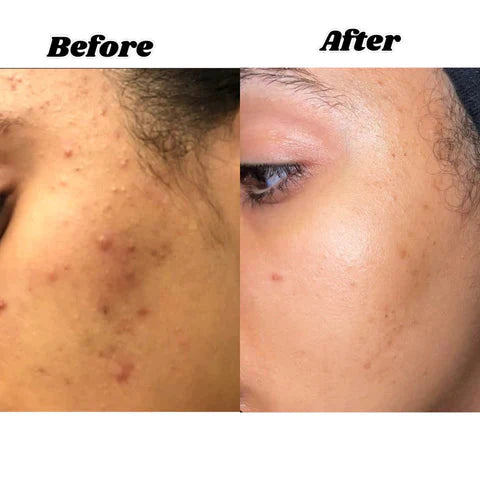 Kojic acid & Turmeric Brightening Soap