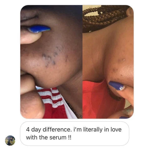 Turmeric Clear Skin Soap